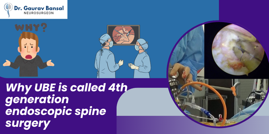 Why UBE is Called 4th Generation Endoscopic Spine Surgery?