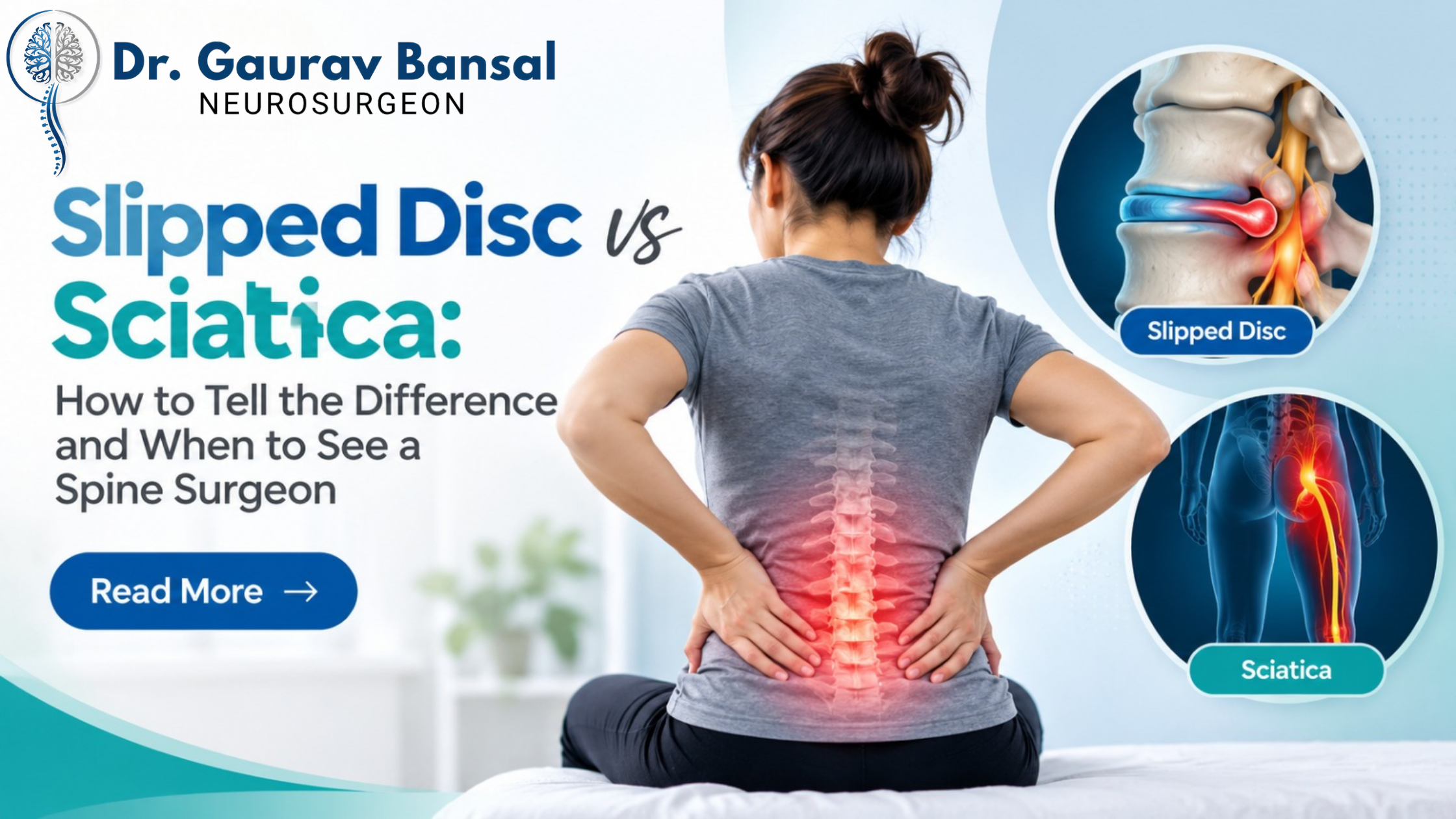 Slipped Disc vs Sciatica: Symptoms, Causes & Treatment