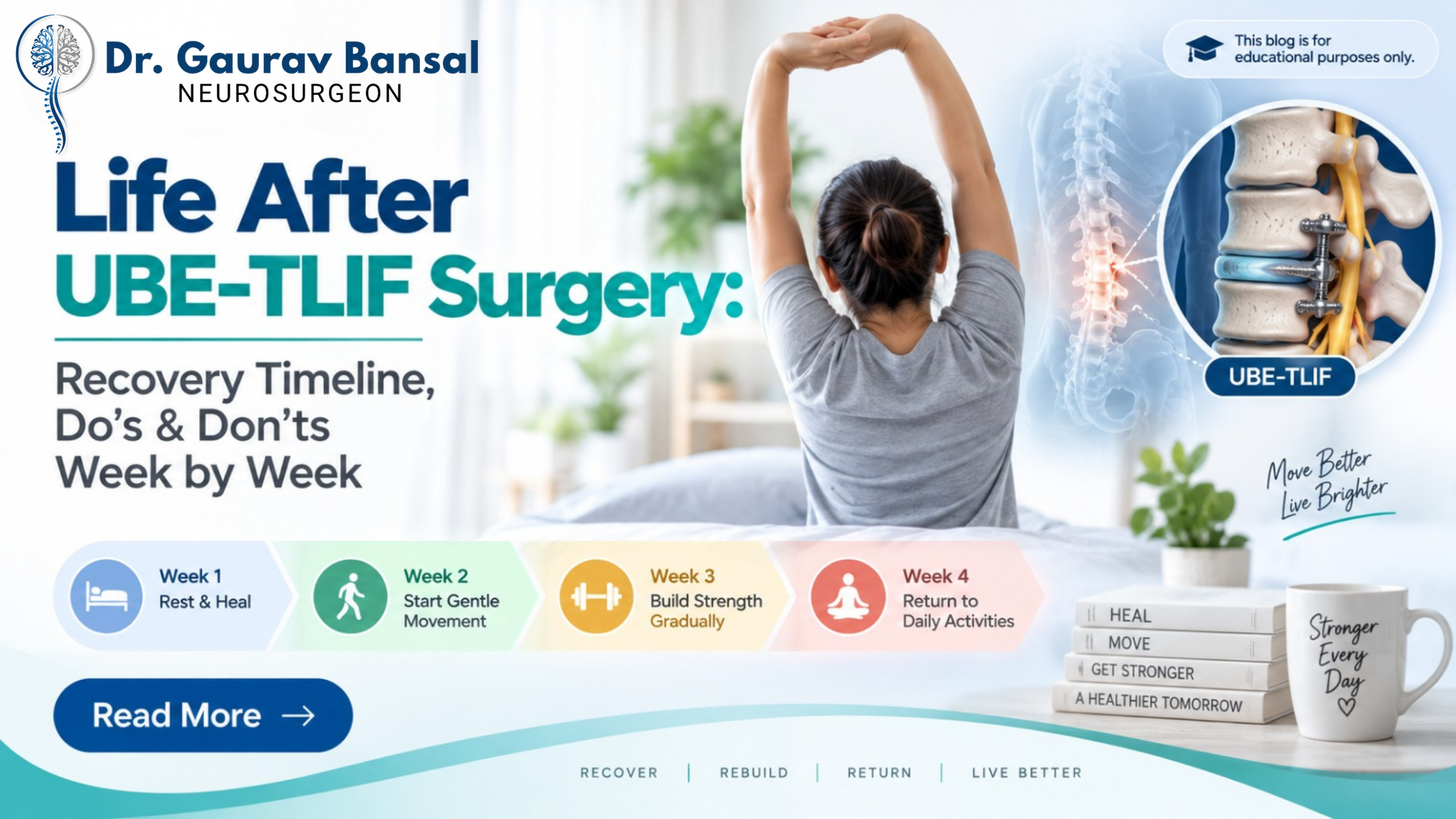 Life After UBE-TLIF Surgery: Recovery Timeline, Do's & Don'ts Week by Week